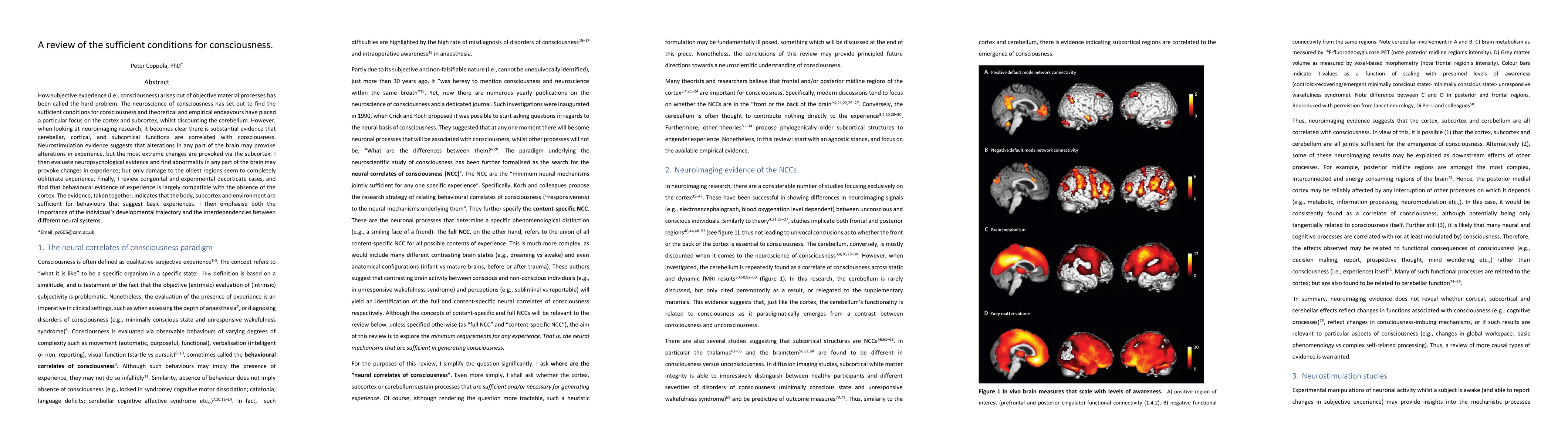 Thumbnail for A review of the sufficient conditions for consciousness