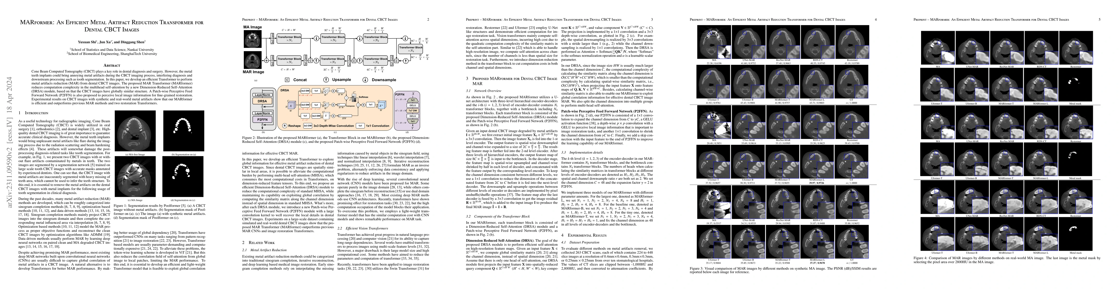 Thumbnail for MARformer: An Efficient Metal Artifact Reduction Transformer for Dental
  CBCT Images