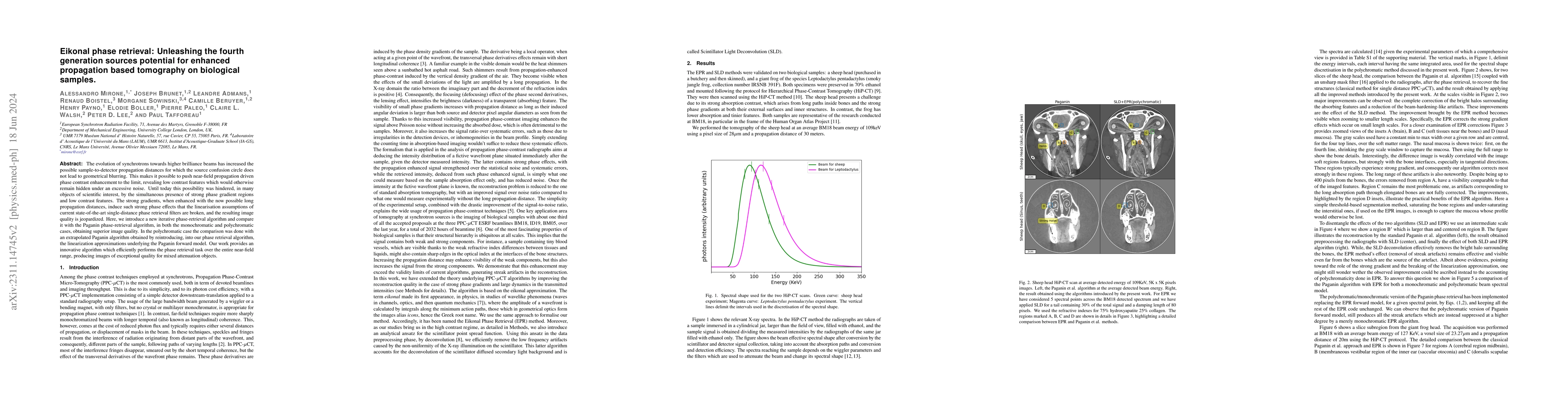 Thumbnail for Eikonal phase retrieval: Unleashing the fourth generation sources
  potential for enhanced propagation based tomography on biological samples