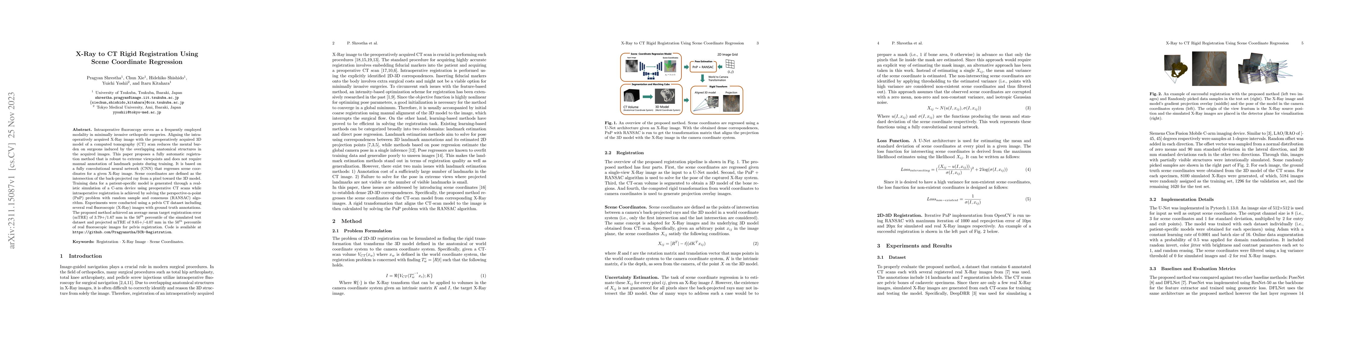 Thumbnail for X-Ray to CT Rigid Registration Using Scene Coordinate Regression