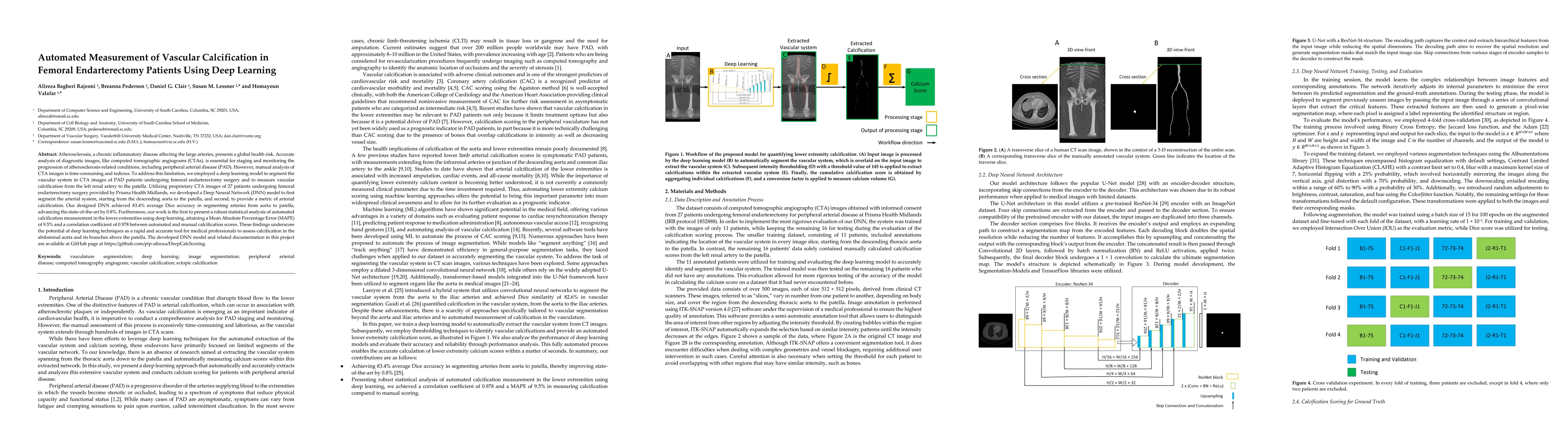 Thumbnail for Automated Measurement of Vascular Calcification in Femoral
  Endarterectomy Patients Using Deep Learning