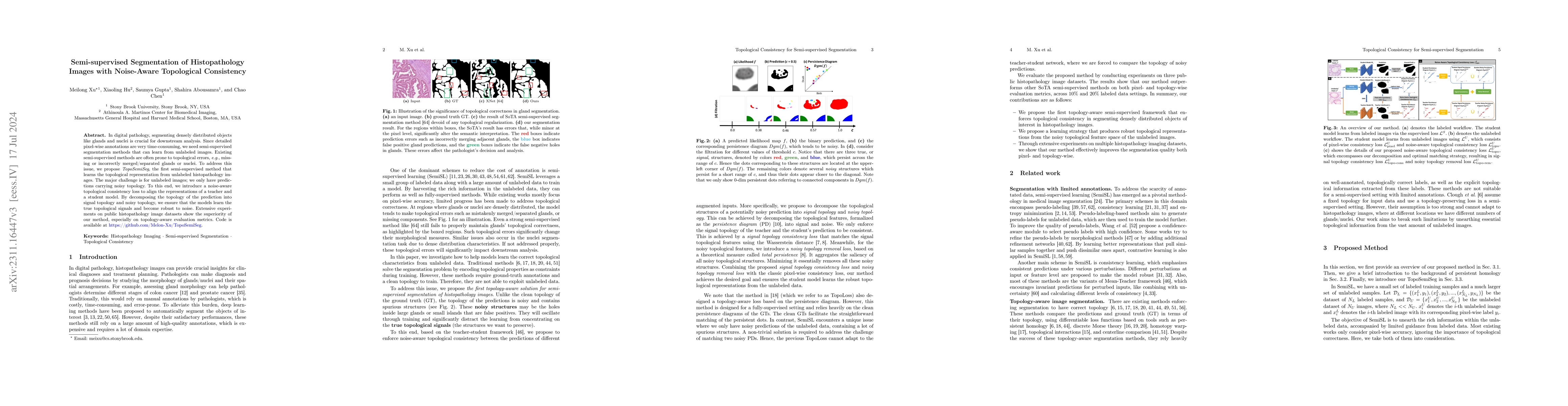 Thumbnail for Semi-supervised Segmentation of Histopathology Images with Noise-Aware
  Topological Consistency