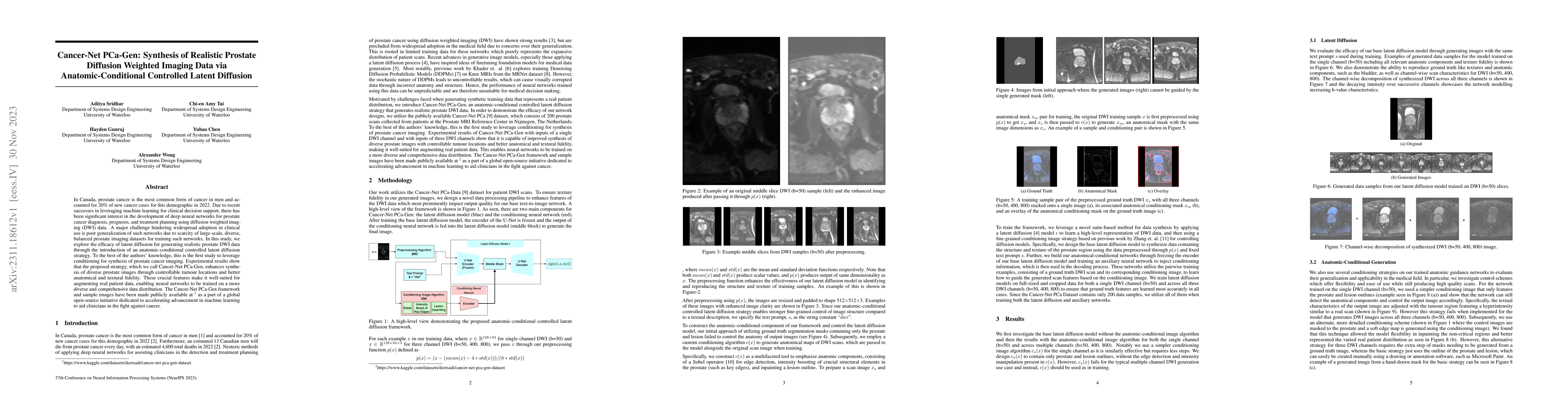 Thumbnail for Cancer-Net PCa-Gen: Synthesis of Realistic Prostate Diffusion Weighted
  Imaging Data via Anatomic-Conditional Controlled Latent Diffusion