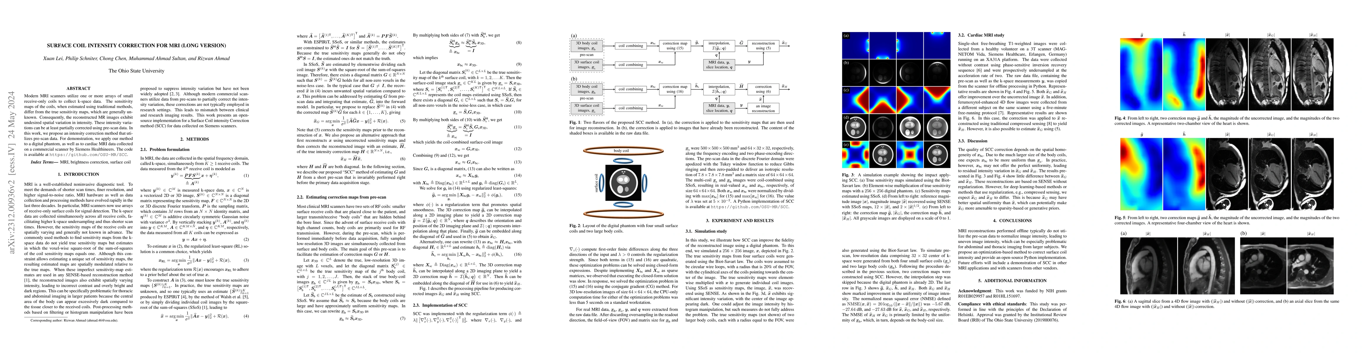 Thumbnail for Surface Coil Intensity Correction for MRI