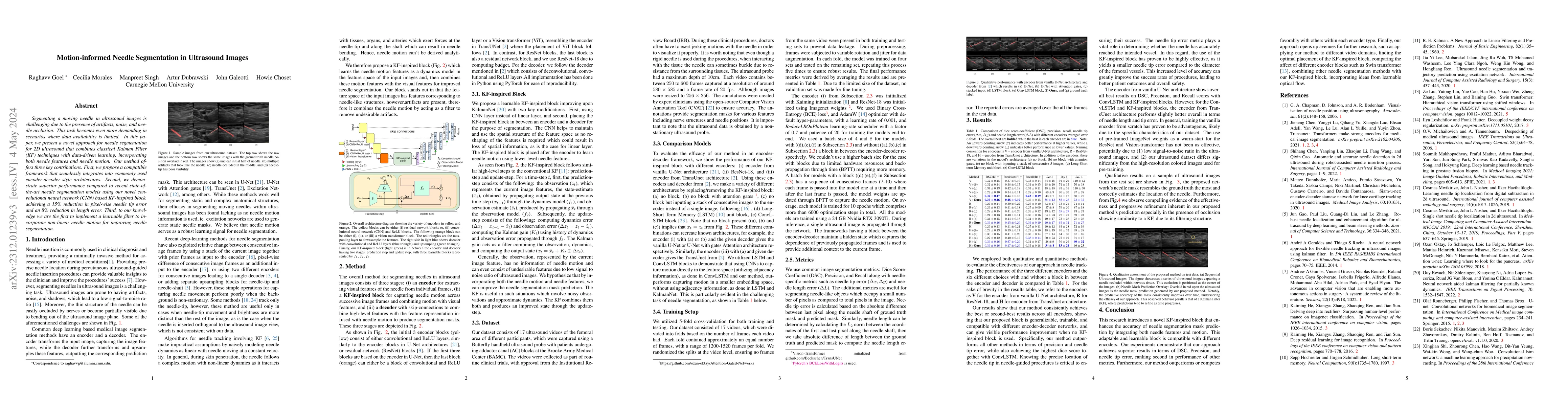 Thumbnail for Motion Informed Needle Segmentation in Ultrasound Images