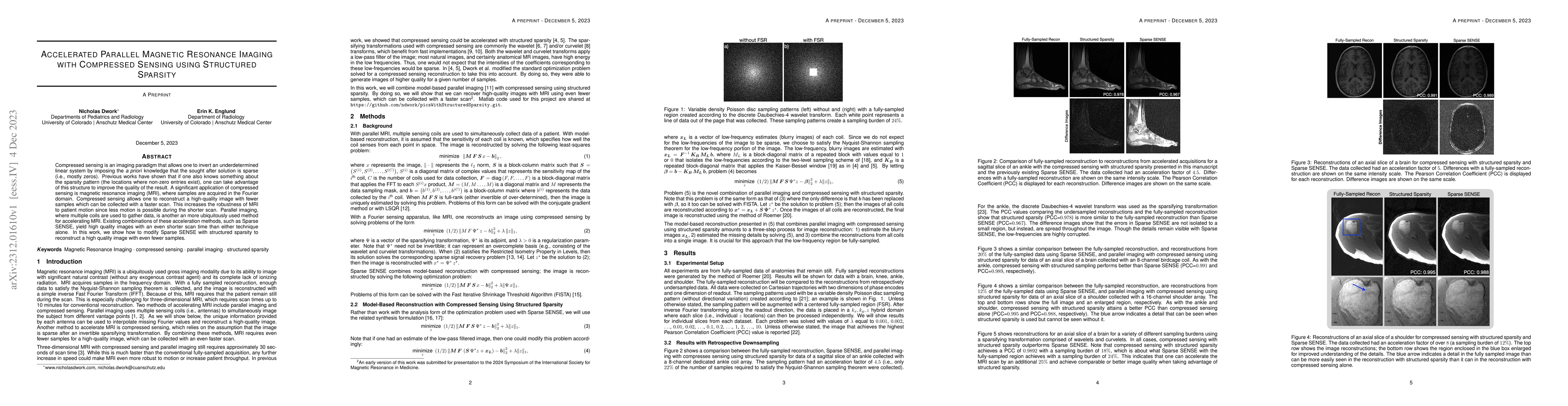 Thumbnail for Accelerated Parallel Magnetic Resonance Imaging with Compressed Sensing
  using Structured Sparsity
