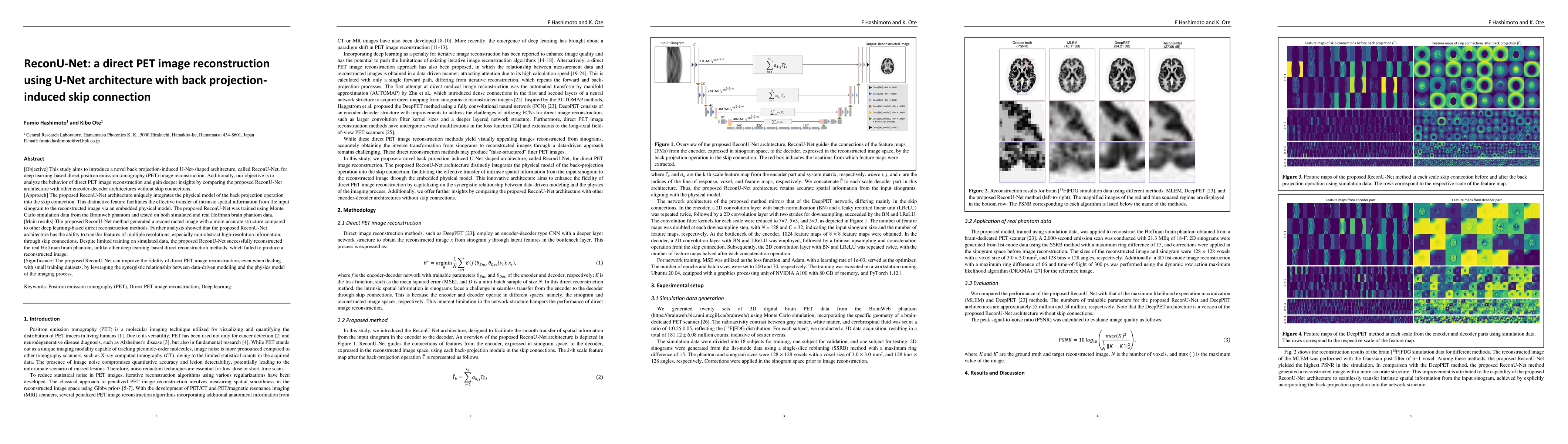 Thumbnail for ReconU-Net: a direct PET image reconstruction using U-Net architecture
  with back projection-induced skip connection