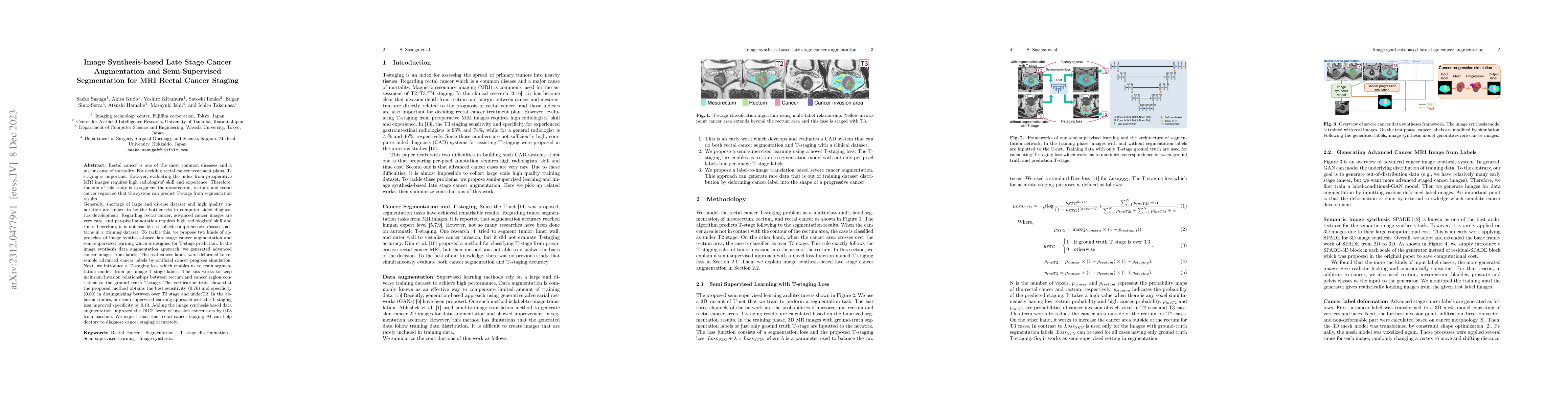 Thumbnail for Image Synthesis-based Late Stage Cancer Augmentation and Semi-Supervised
  Segmentation for MRI Rectal Cancer Staging
