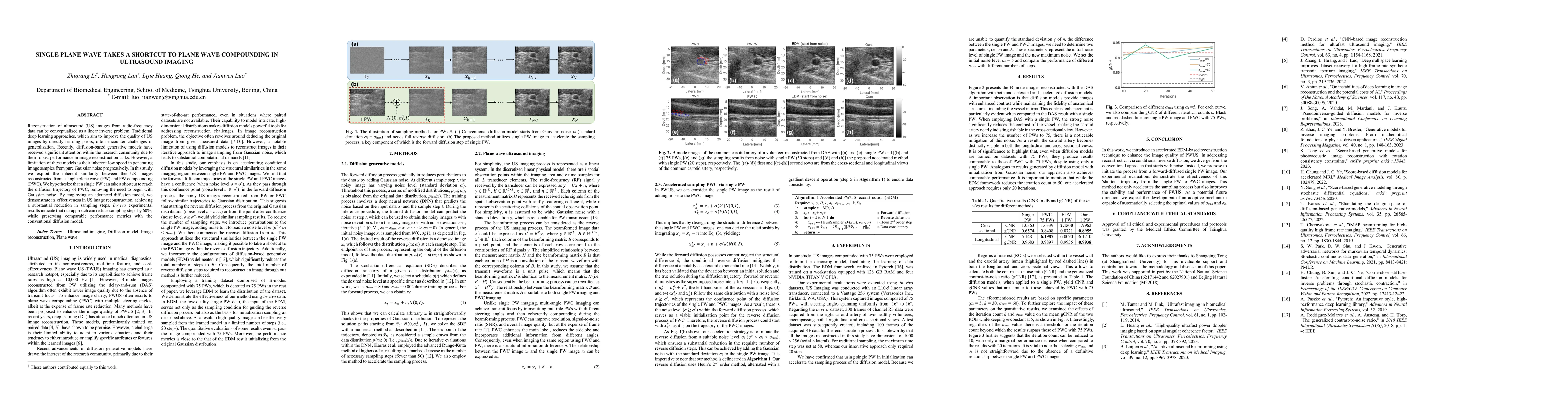 Thumbnail for Single PW takes a shortcut to compound PW in US imaging