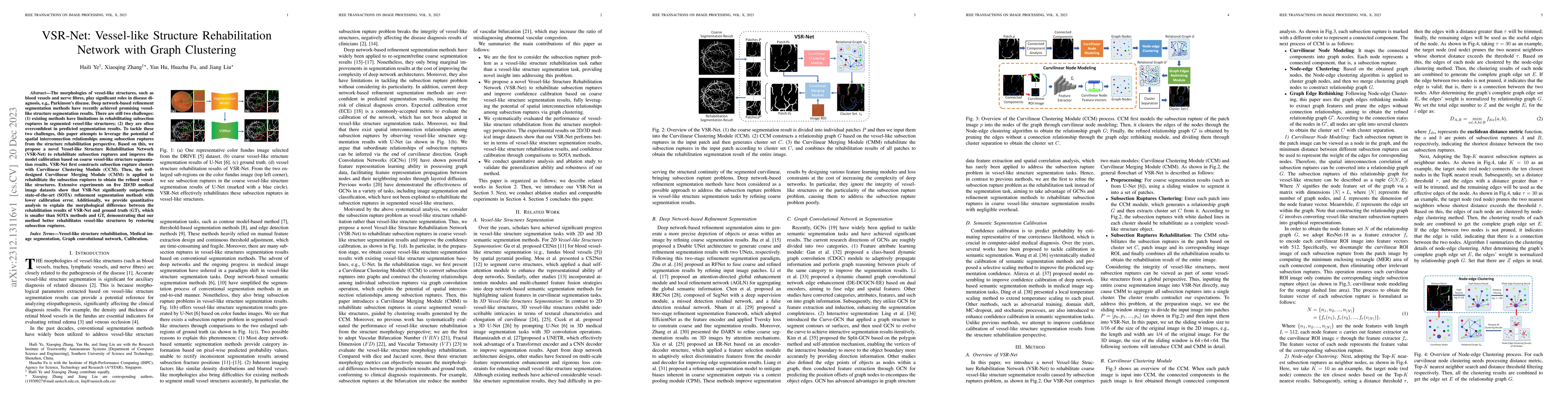 Thumbnail for VSR-Net: Vessel-like Structure Rehabilitation Network with Graph
  Clustering