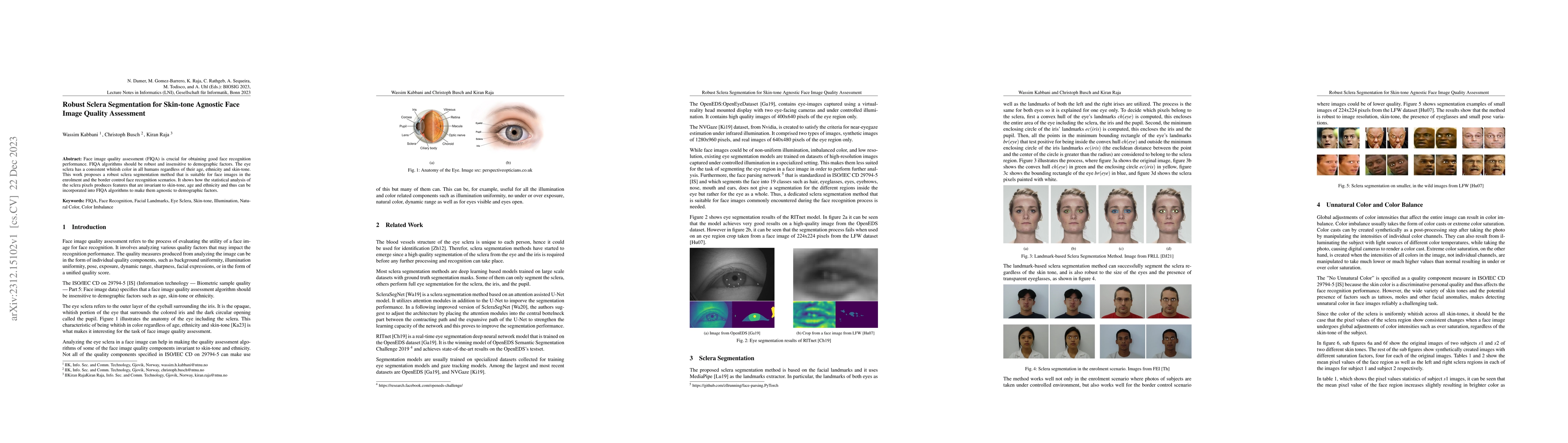 Thumbnail for Robust Sclera Segmentation for Skin-tone Agnostic Face Image Quality
  Assessment