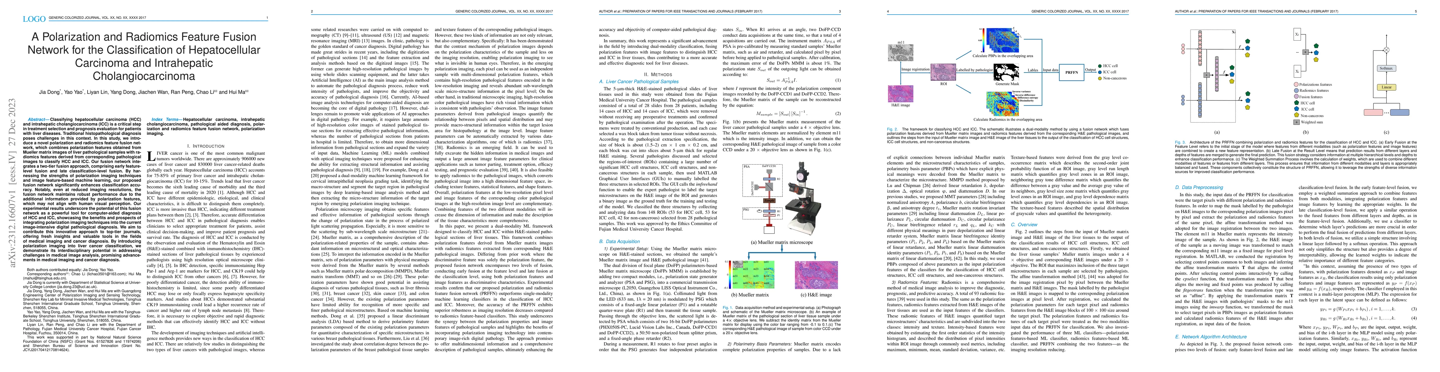 Thumbnail for A Polarization and Radiomics Feature Fusion Network for the
  Classification of Hepatocellular Carcinoma and Intrahepatic
  Cholangiocarcinoma
