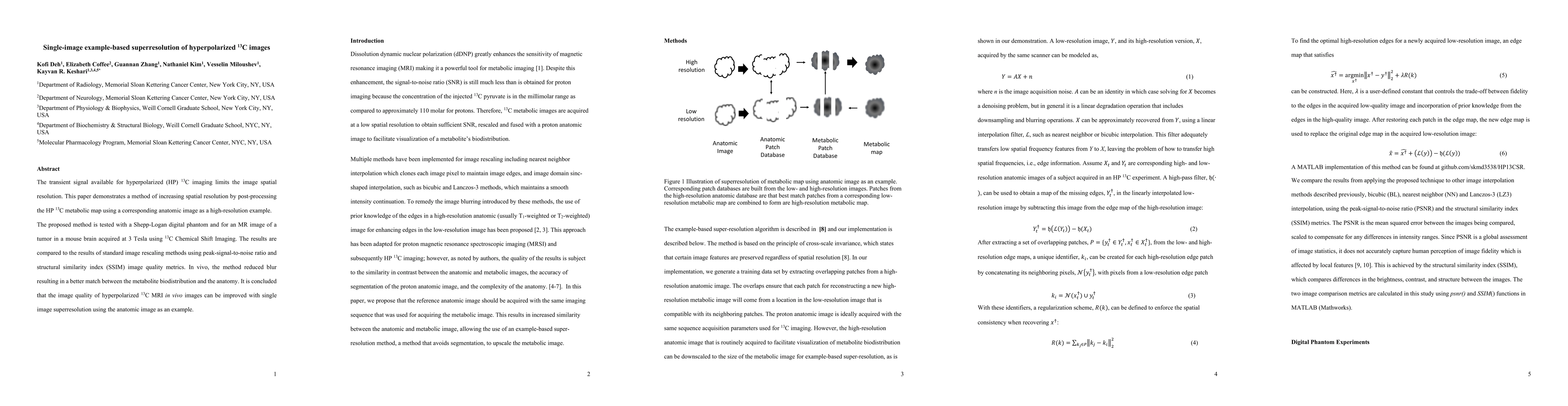 Thumbnail for Single-image example-based superresolution of hyperpolarized 13C images