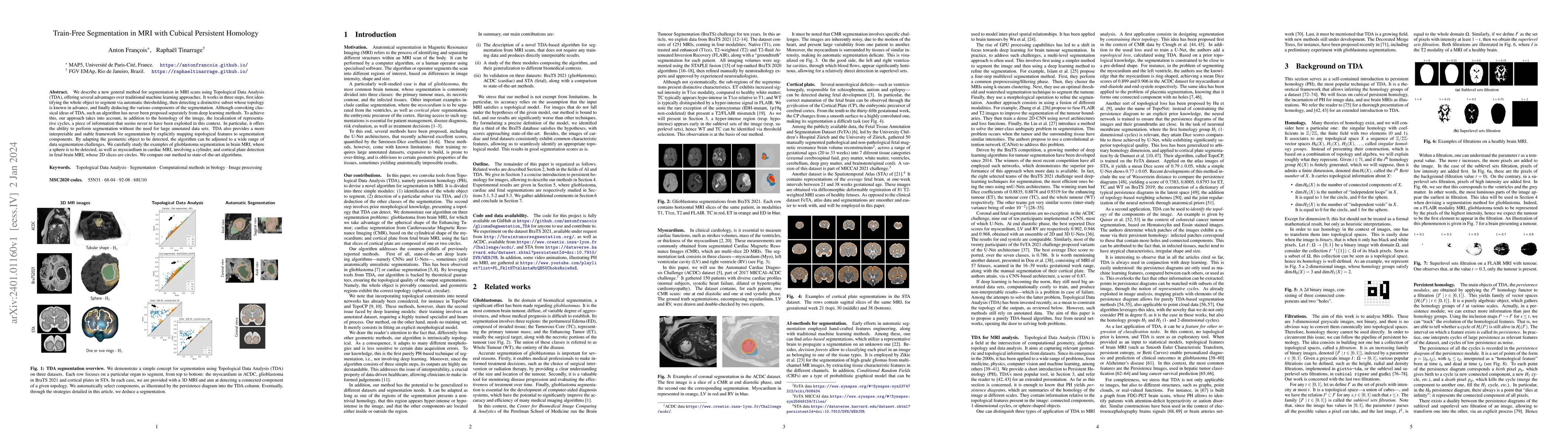 Thumbnail for Train-Free Segmentation in MRI with Cubical Persistent Homology