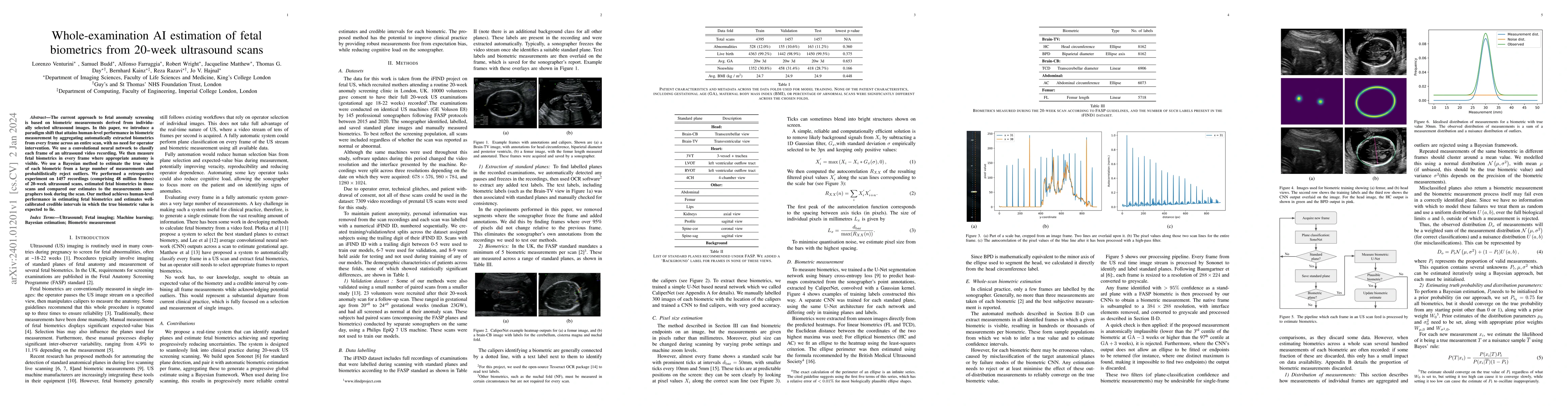 Thumbnail for Whole-examination AI estimation of fetal biometrics from 20-week
  ultrasound scans
