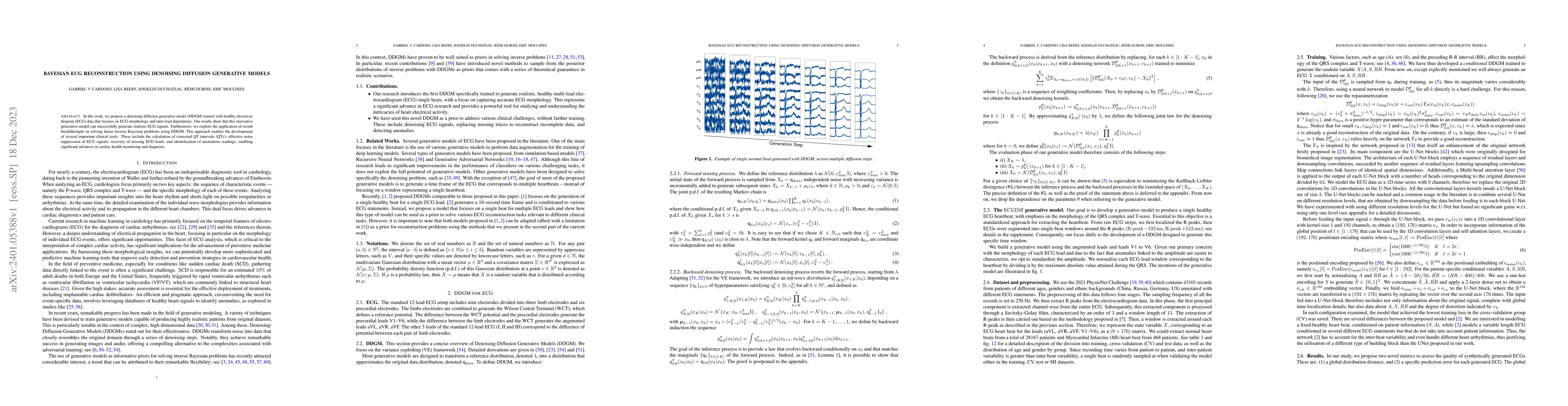 Thumbnail for Bayesian ECG reconstruction using denoising diffusion generative models