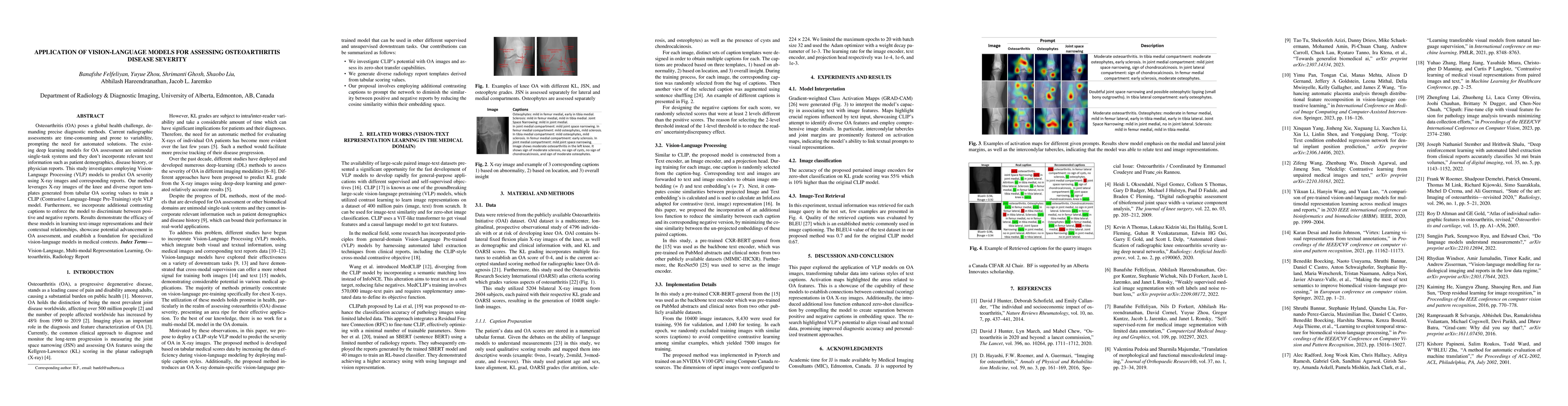 Thumbnail for Application Of Vision-Language Models For Assessing Osteoarthritis
  Disease Severity