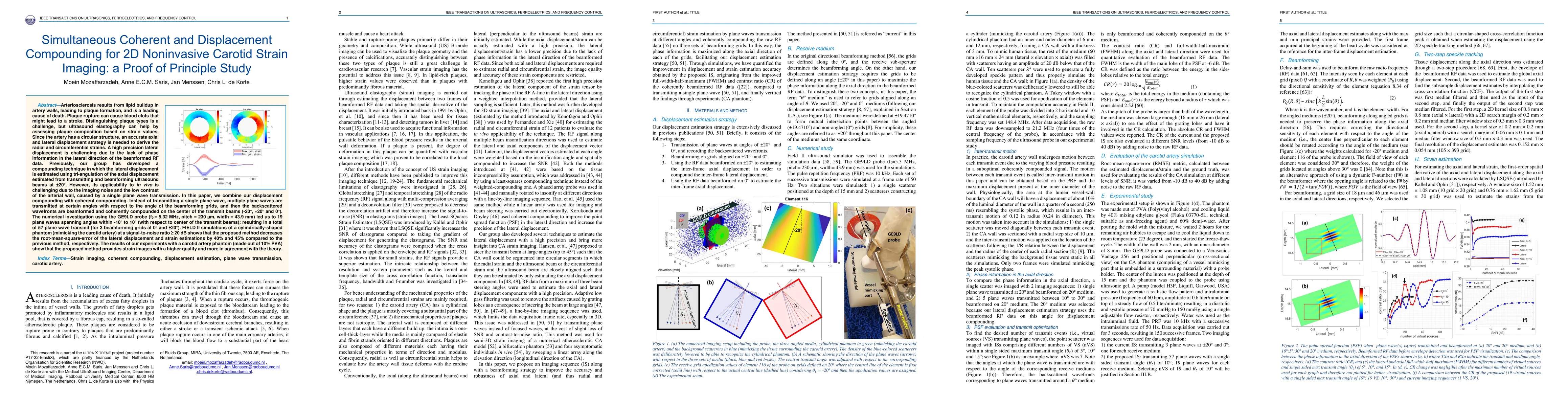 Thumbnail for Simultaneous Coherent and Displacement Compounding for 2D Noninvasive
  Carotid Strain Imaging: a Proof of Principle Study