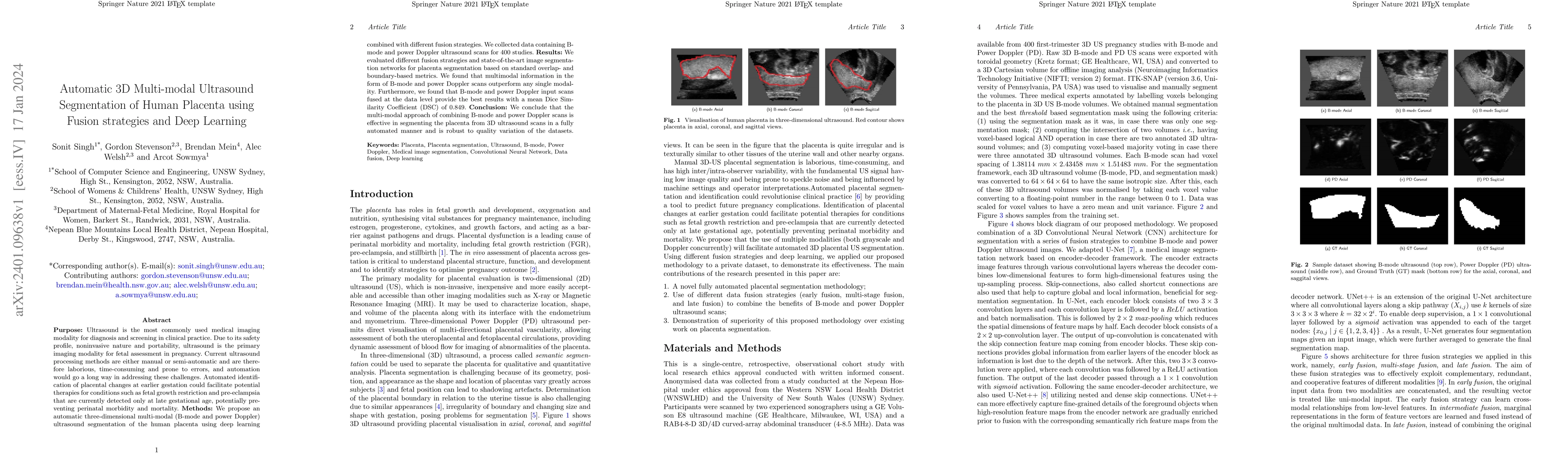 Thumbnail for Automatic 3D Multi-modal Ultrasound Segmentation of Human Placenta using
  Fusion Strategies and Deep Learning