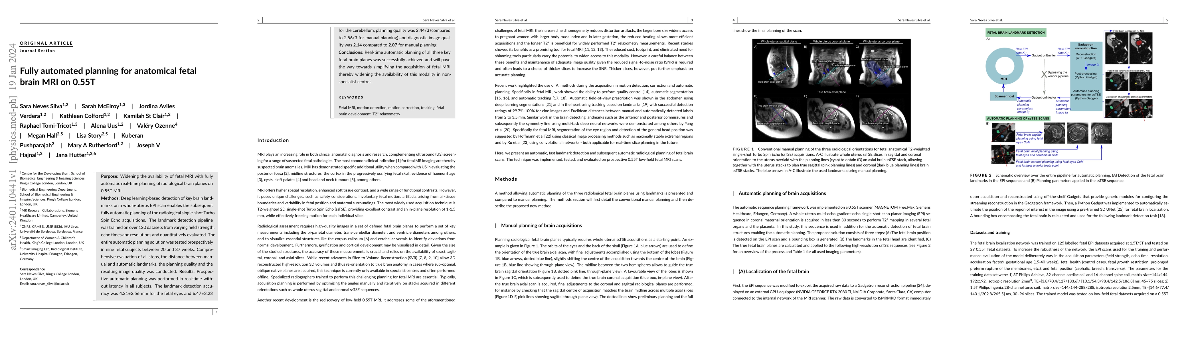 Thumbnail for Fully automated planning for anatomical fetal brain MRI on 0.55T