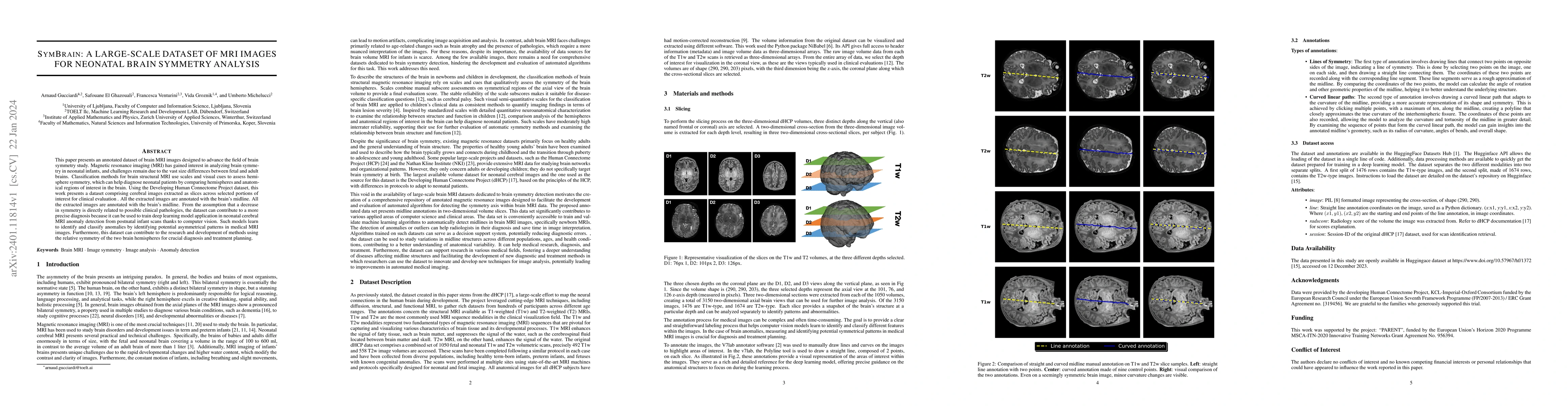 Thumbnail for Symbrain: A large-scale dataset of MRI images for neonatal brain
  symmetry analysis