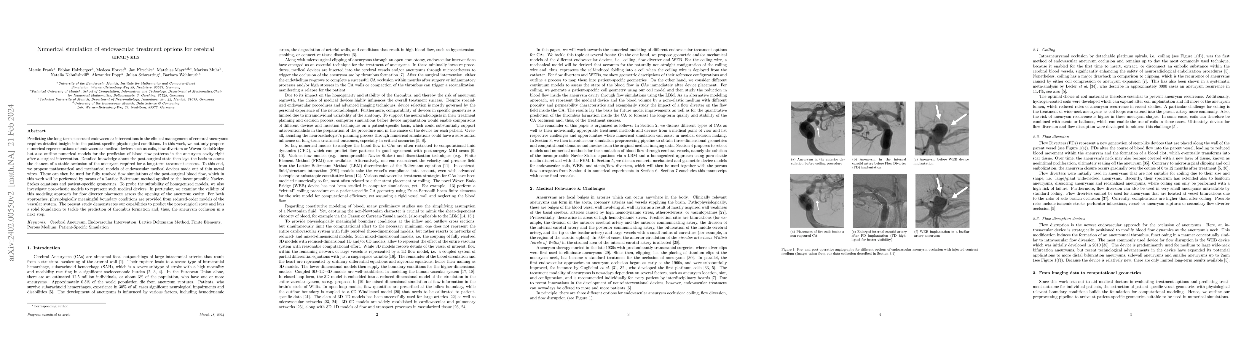 Thumbnail for Numerical simulation of endovascular treatment options for cerebral
  aneurysms