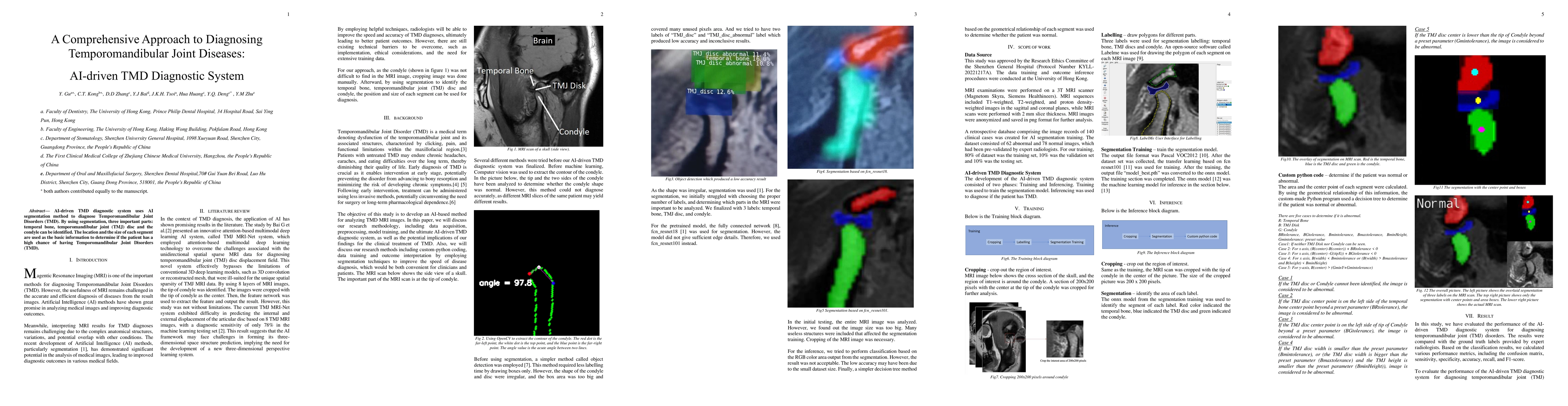 Thumbnail for A Comprehensive Approach to Diagnosing Temporomandibular Joint Diseases:
  AI-driven TMD Diagnostic System