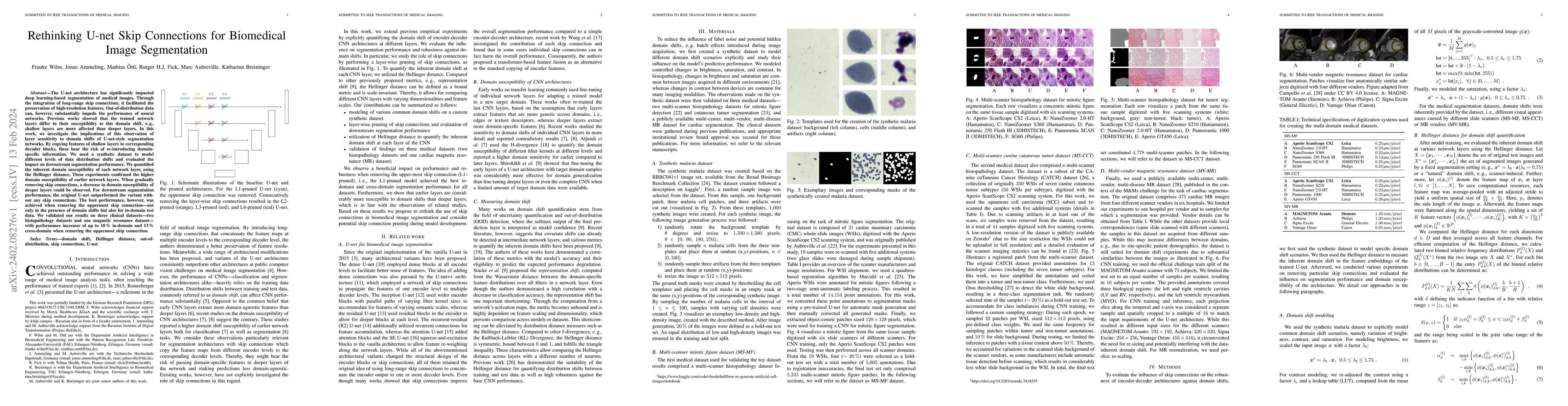 Thumbnail for Rethinking U-net Skip Connections for Biomedical Image Segmentation