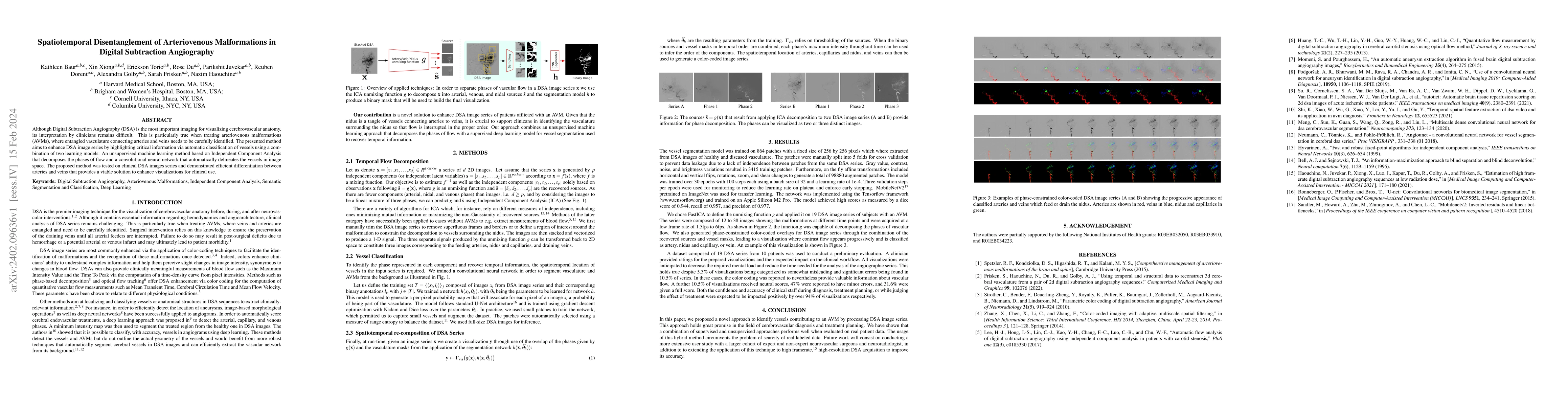 Thumbnail for Spatiotemporal Disentanglement of Arteriovenous Malformations in Digital
  Subtraction Angiography