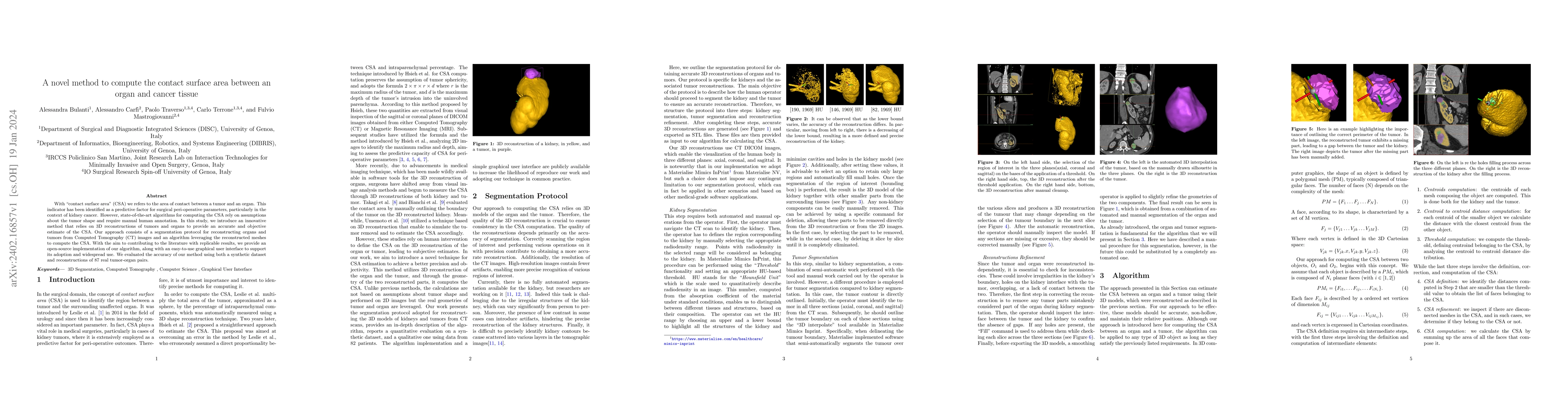 Thumbnail for A novel method to compute the contact surface area between an organ and
  cancer tissue