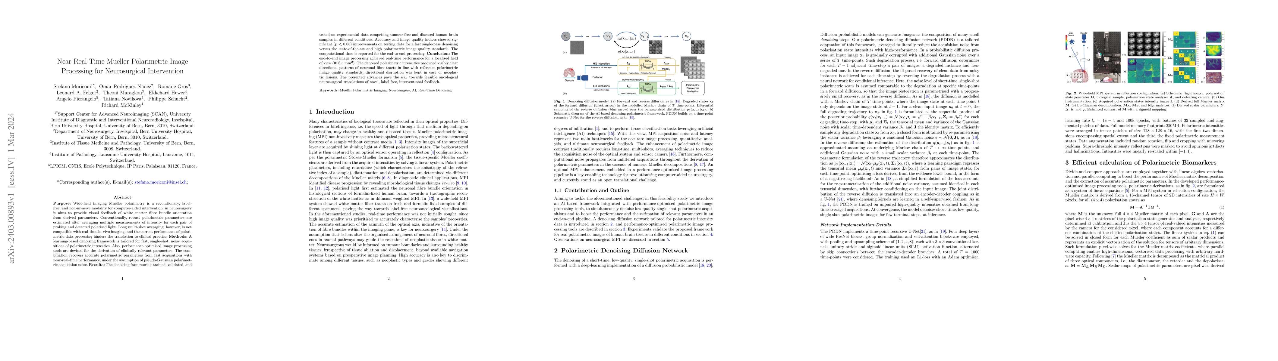 Thumbnail for Near-Real-Time Mueller Polarimetric Image Processing for Neurosurgical
  Intervention