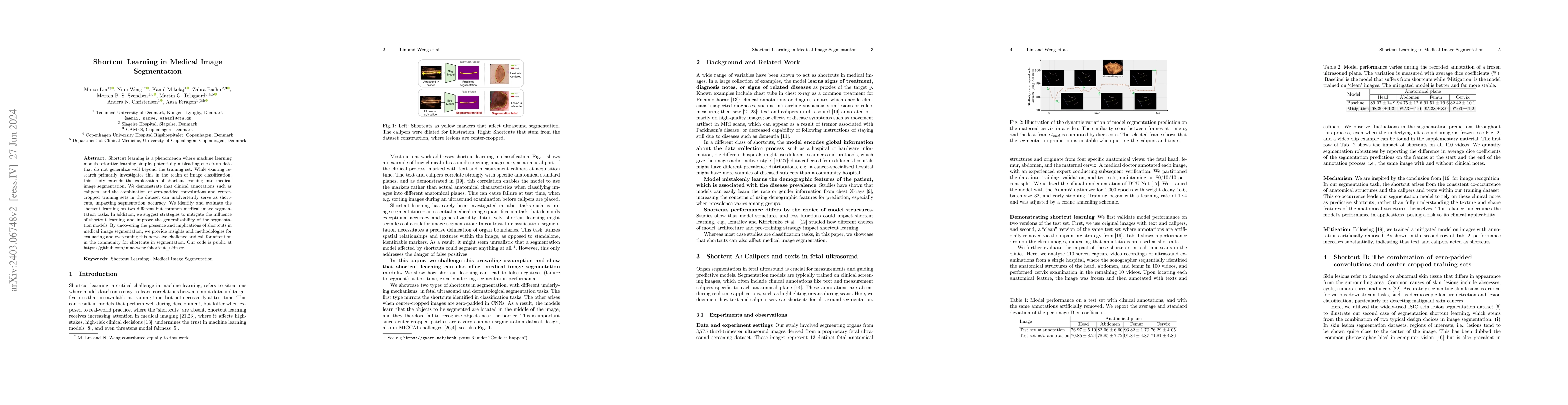 Thumbnail for Shortcut Learning in Medical Image Segmentation
