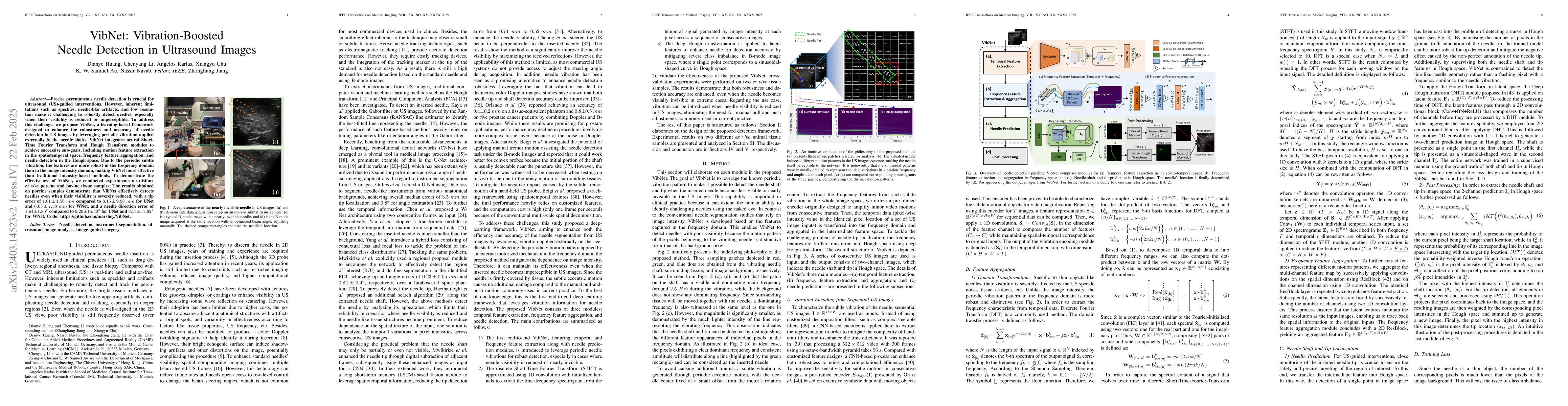 Thumbnail for Invisible Needle Detection in Ultrasound: Leveraging Mechanism-Induced
  Vibration