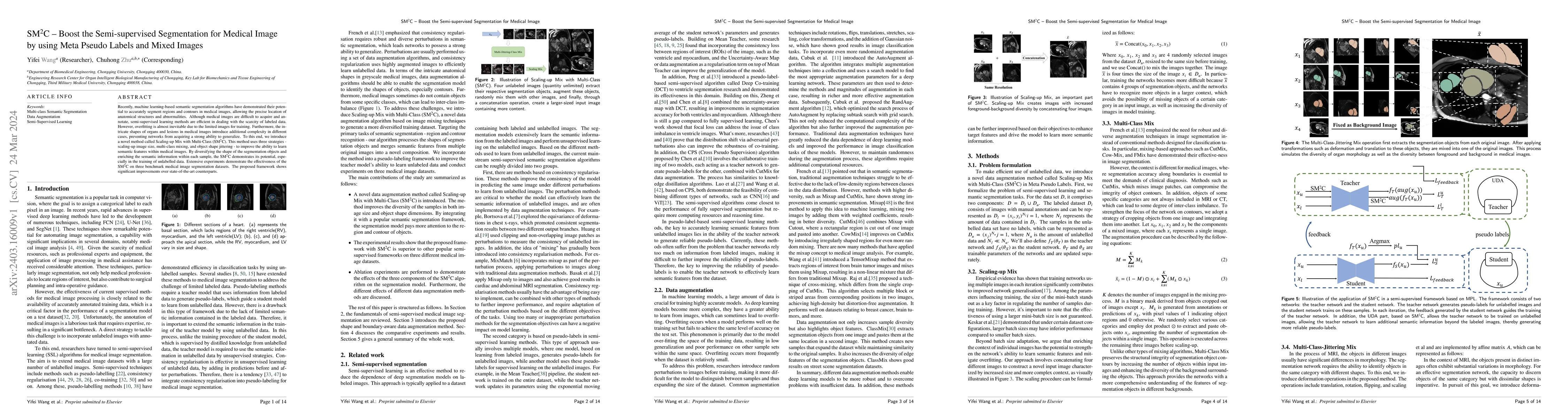 Thumbnail for SM2C: Boost the Semi-supervised Segmentation for Medical Image by using
  Meta Pseudo Labels and Mixed Images