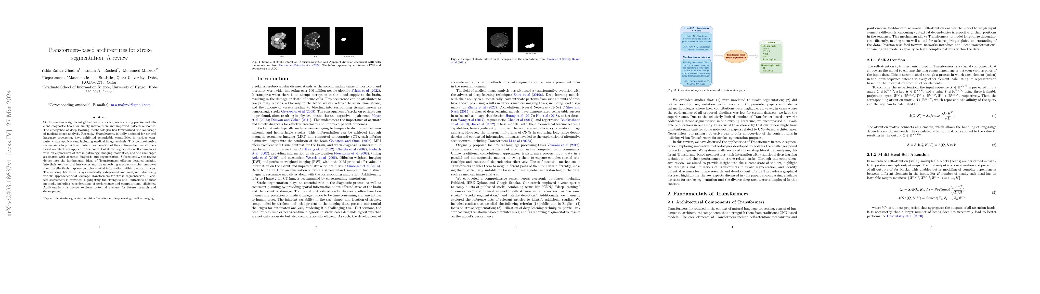 Thumbnail for Transformers-based architectures for stroke segmentation: A review