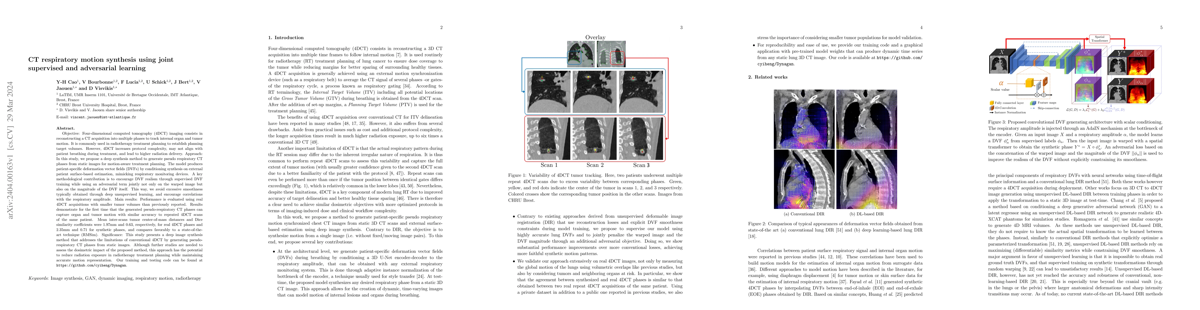 Thumbnail for CT respiratory motion synthesis using joint supervised and adversarial
  learning