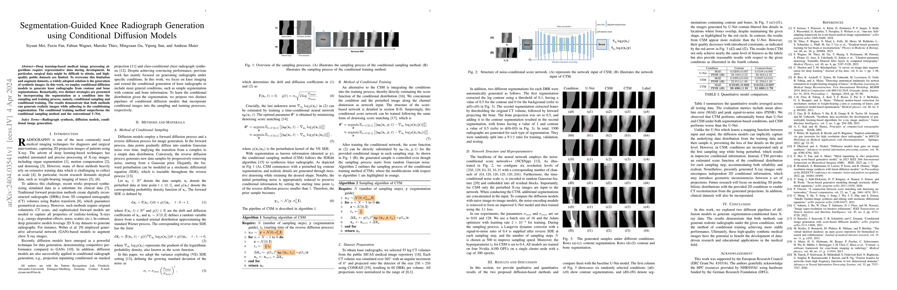 Thumbnail for Segmentation-Guided Knee Radiograph Generation using Conditional
  Diffusion Models