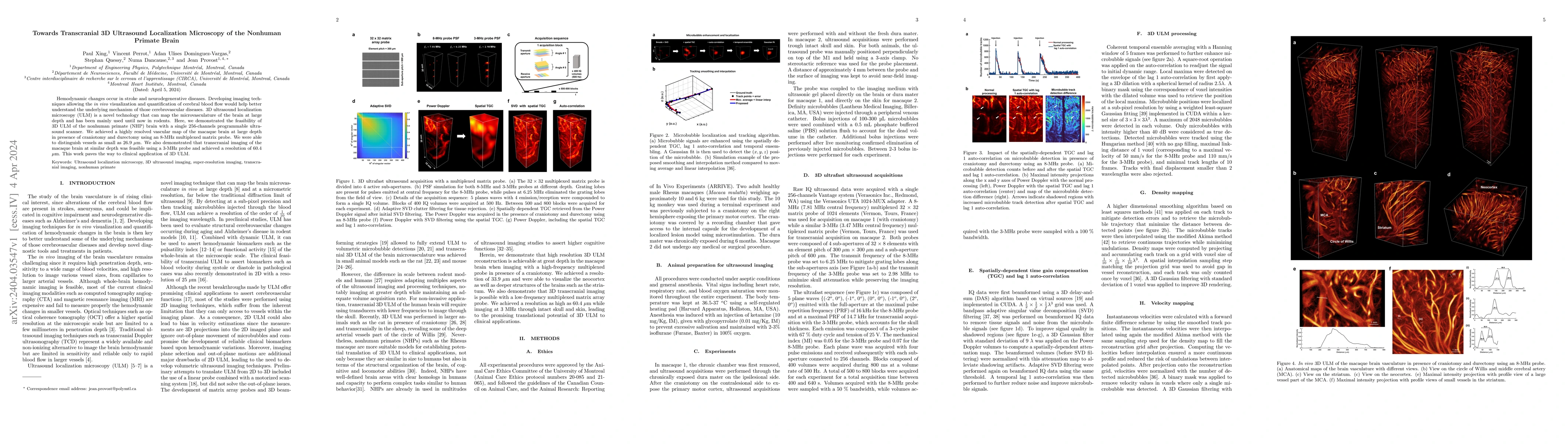 Thumbnail for Towards Transcranial 3D Ultrasound Localization Microscopy of the
  Nonhuman Primate Brain