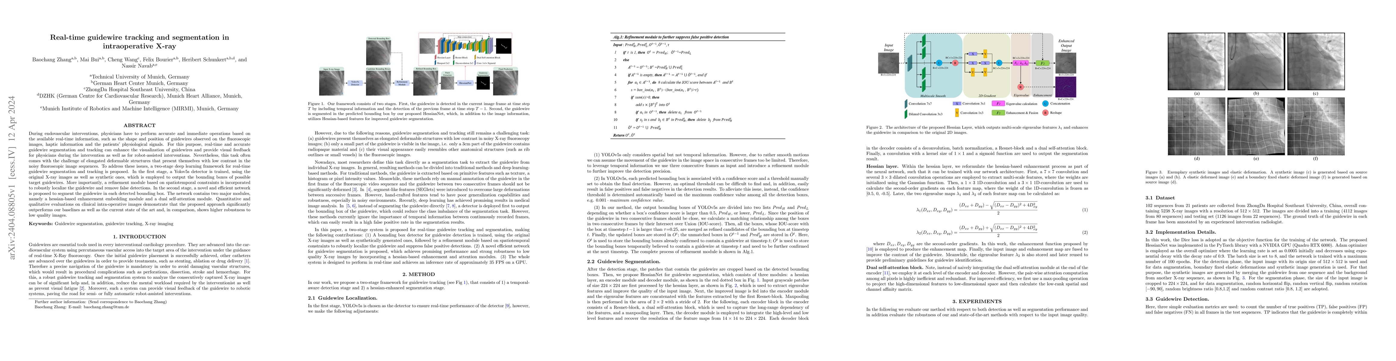 Thumbnail for Real-time guidewire tracking and segmentation in intraoperative x-ray