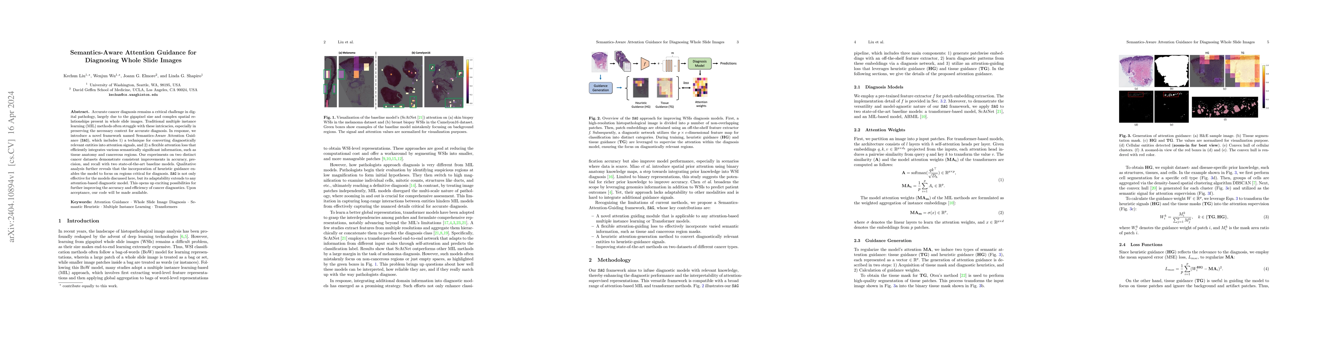 Thumbnail for Semantics-Aware Attention Guidance for Diagnosing Whole Slide Images