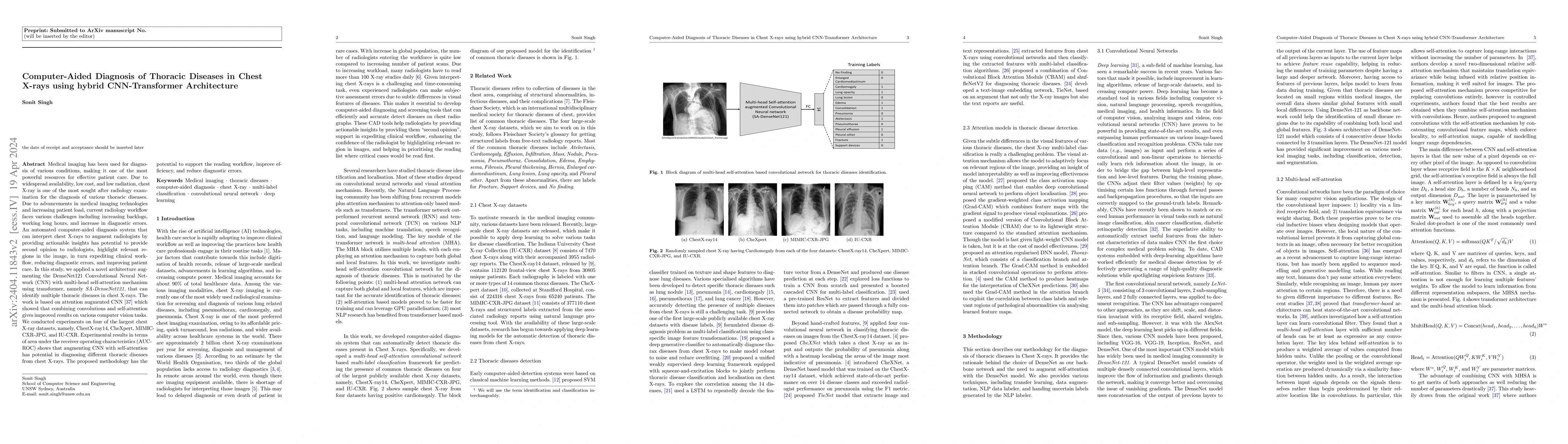 Thumbnail for Computer-Aided Diagnosis of Thoracic Diseases in Chest X-rays using
  hybrid CNN-Transformer Architecture