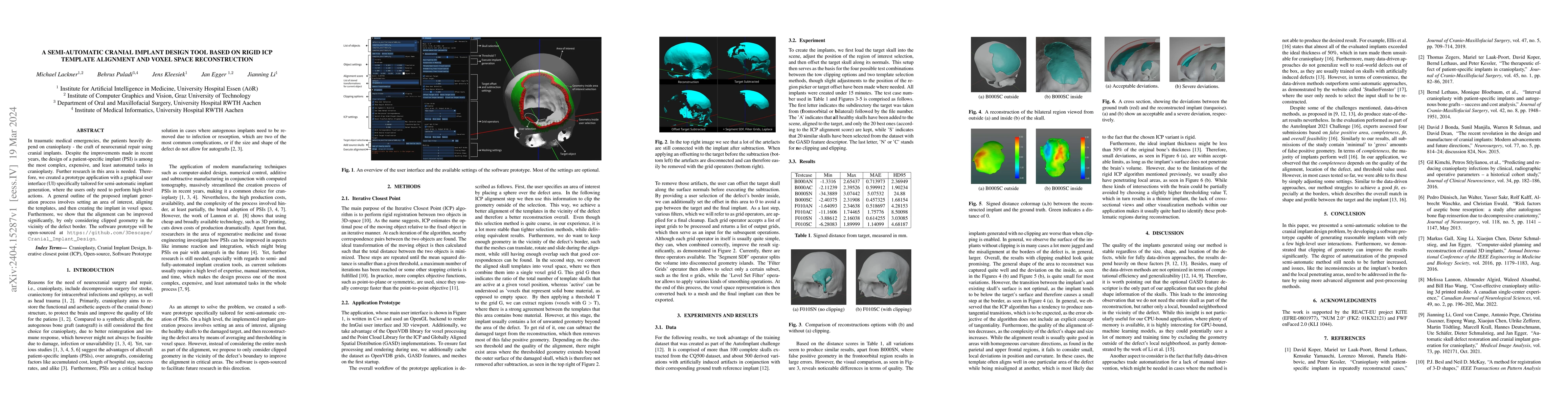 Thumbnail for A Semi-automatic Cranial Implant Design Tool Based on Rigid ICP Template
  Alignment and Voxel Space Reconstruction
