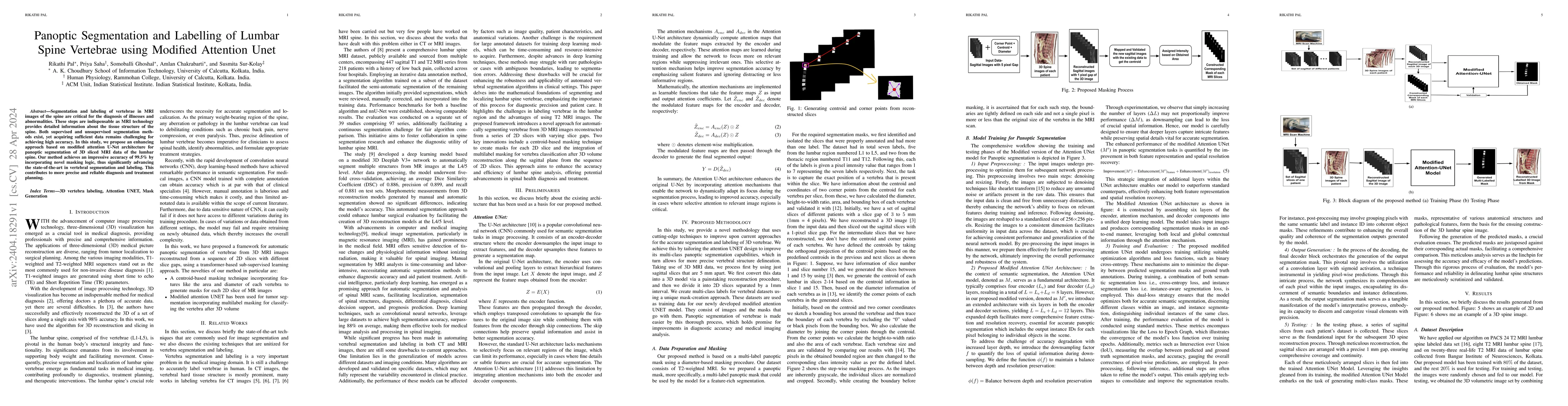 Thumbnail for Panoptic Segmentation and Labelling of Lumbar Spine Vertebrae using
  Modified Attention Unet