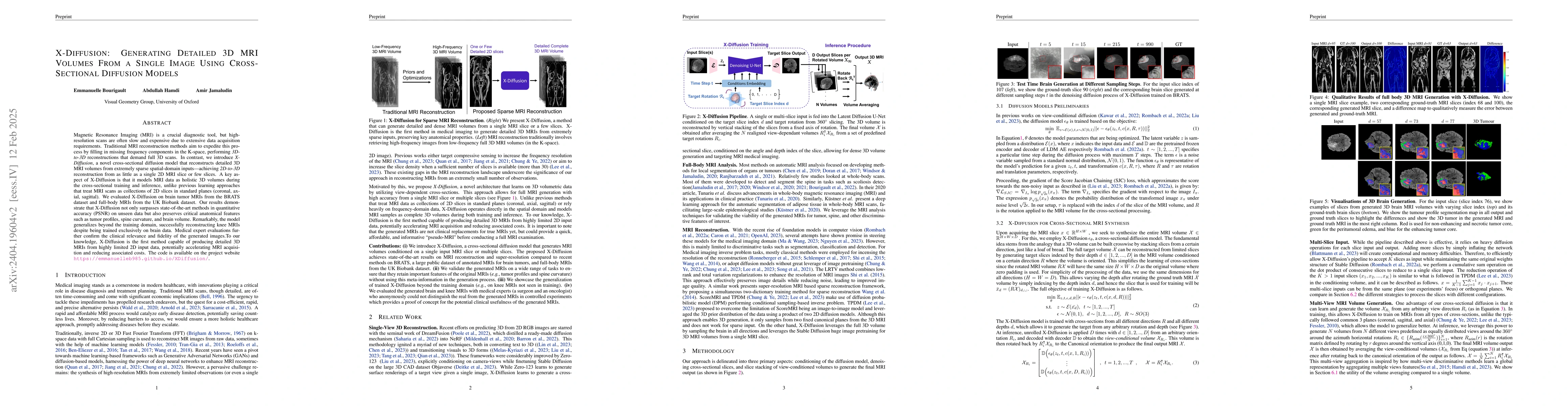 Thumbnail for X-Diffusion: Generating Detailed 3D MRI Volumes From a Single Image
  Using Cross-Sectional Diffusion Models