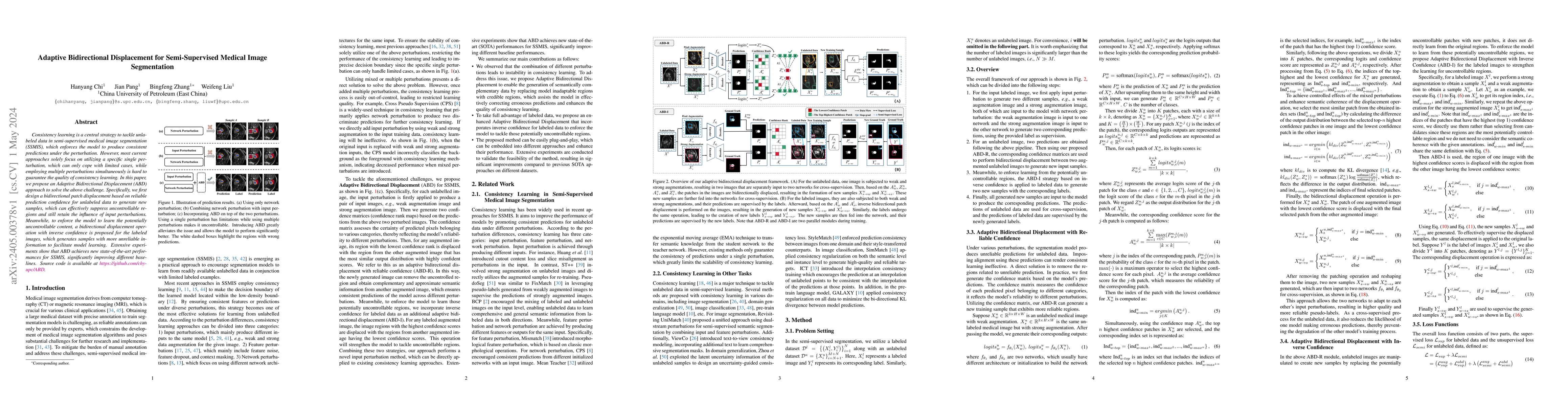 Thumbnail for Adaptive Bidirectional Displacement for Semi-Supervised Medical Image
  Segmentation