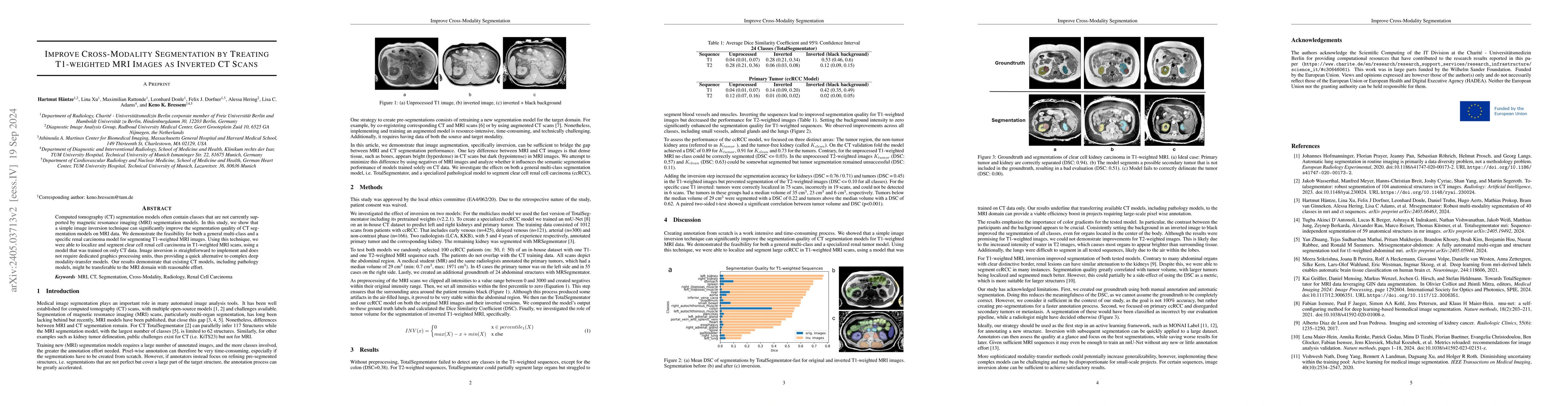 Thumbnail for Improve Cross-Modality Segmentation by Treating MRI Images as Inverted
  CT Scans