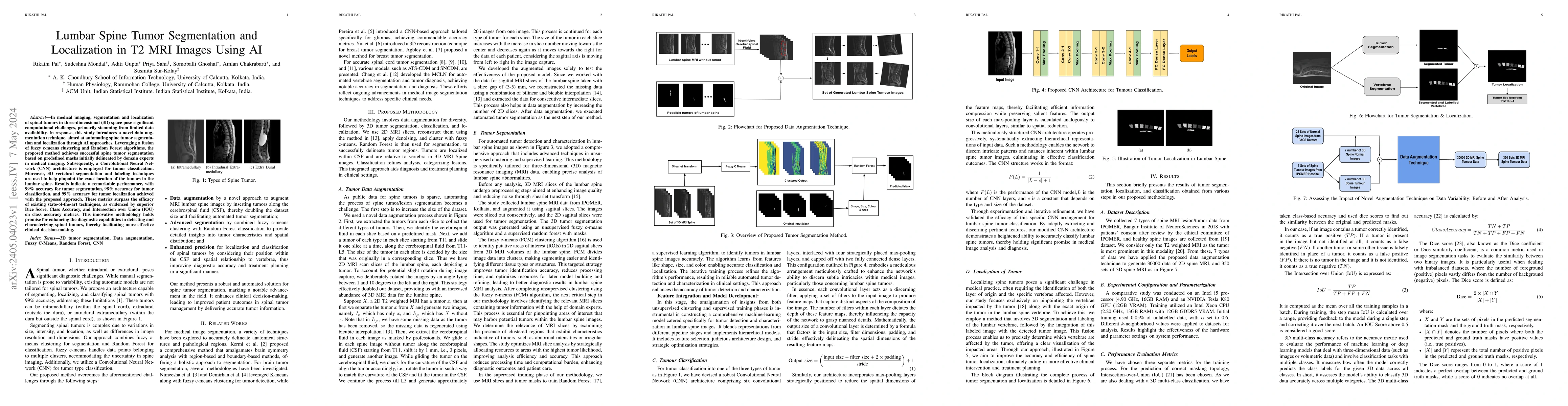 Thumbnail for Lumbar Spine Tumor Segmentation and Localization in T2 MRI Images Using
  AI