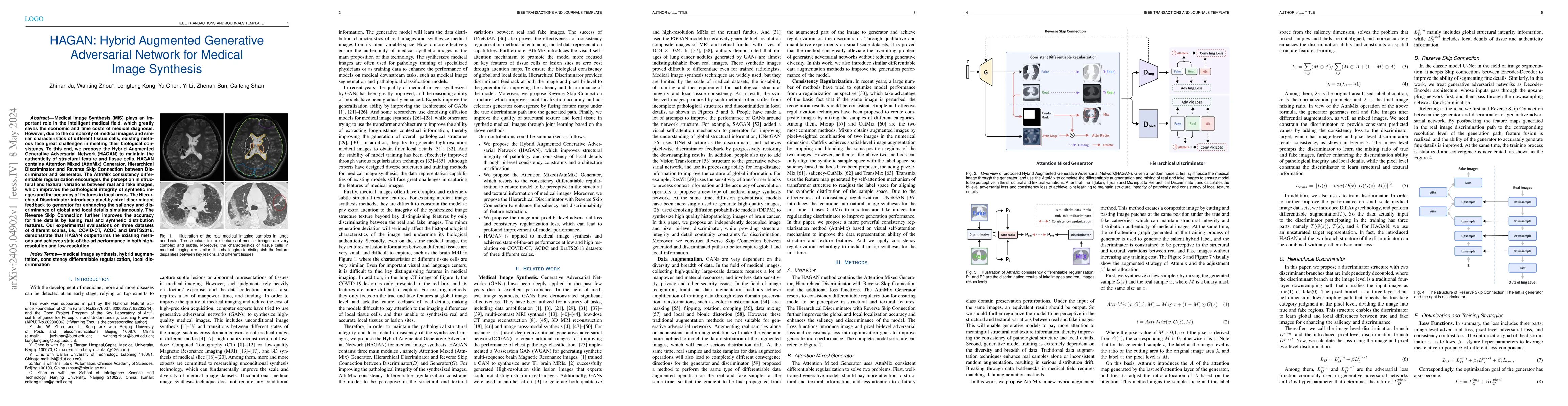 Thumbnail for HAGAN: Hybrid Augmented Generative Adversarial Network for Medical Image
  Synthesis