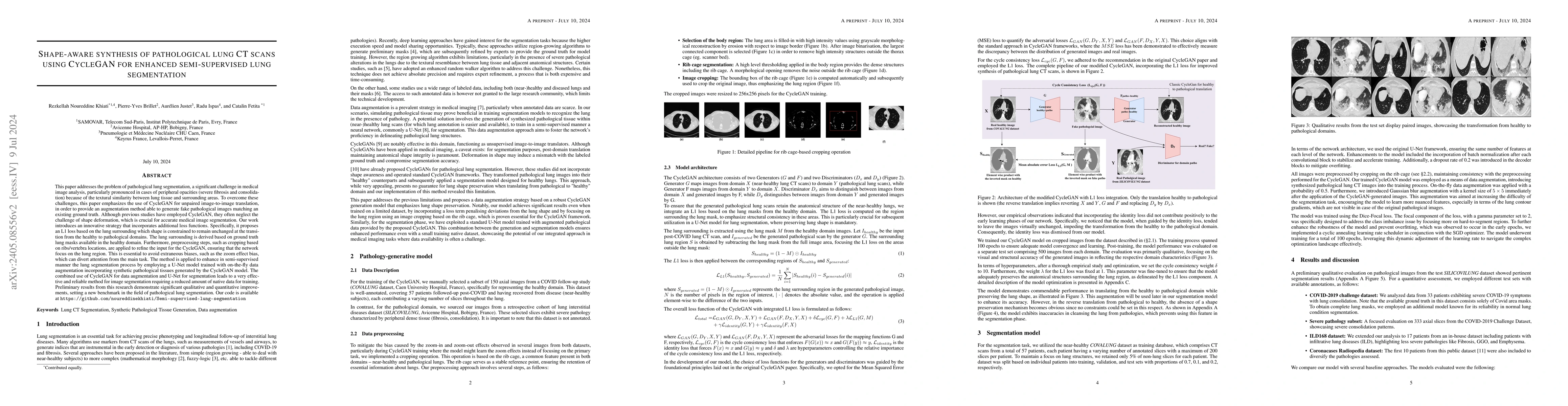 Thumbnail for Shape-aware synthesis of pathological lung CT scans using CycleGAN for
  enhanced semi-supervised lung segmentation