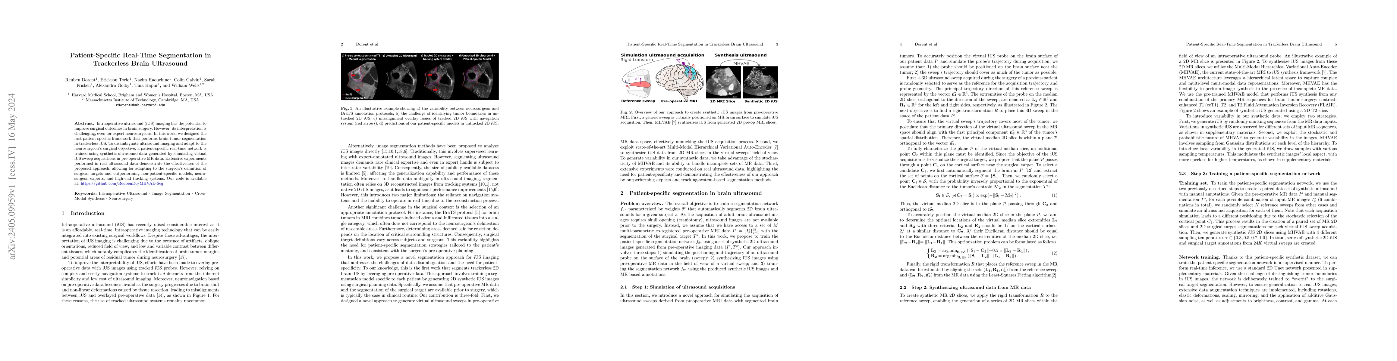 Thumbnail for Patient-Specific Real-Time Segmentation in Trackerless Brain Ultrasound